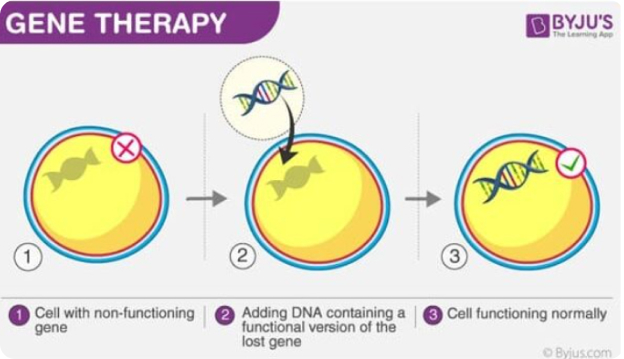 geneTherapgy